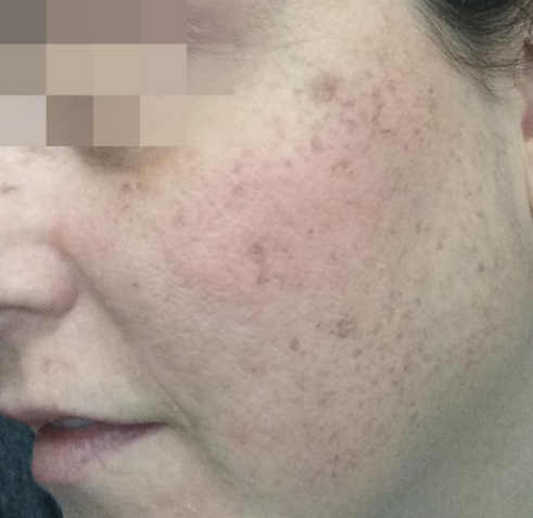 Lumecca - Face Before